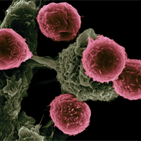 Tumor cells  (colored red and brown) are shown in 3-dimensions against a black background. The cells are close together, emphasizing the importance of cell-cell interactions in supporting tumor growth. 