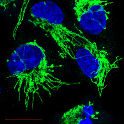 Mitochondrial and nuclear staining to express oncogenic RAS.