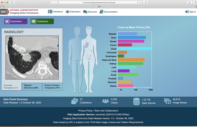 Imaging Data Commons website portal featuring a radiology image and a graph chart, Cases by Major Primary Site. Chest has the most, then brain, head and neck, breast. 