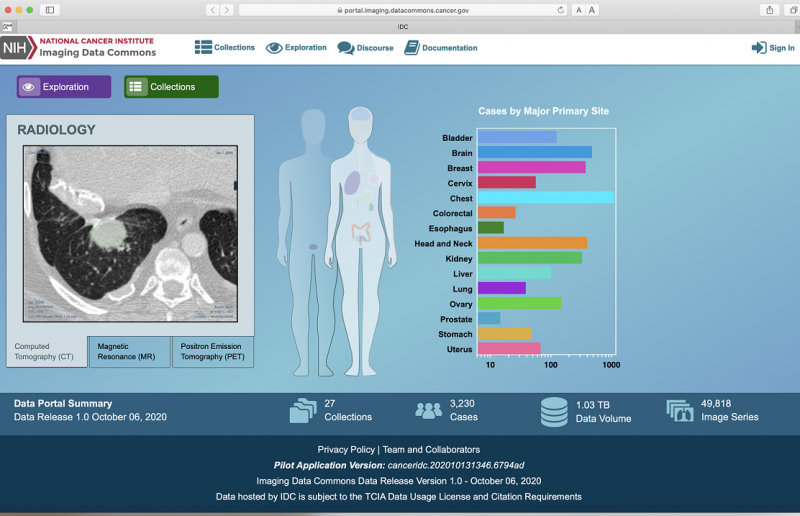 Imaging Data Commons website portal featuring a radiology image and a graph chart, Cases by Major Primary Site. Chest has the most, then brain, head and neck, breast.