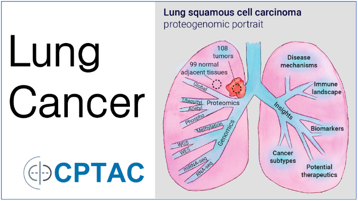 Image of Lung Cancer map developed by CPTAC. On right side contains illustration of lung entitled "Lung squamous cell carcinoma proteogenomic portrait". The illustration has a red tumor added to the primal bronchii with the text above it stating 108 tumors. Text next to the tumor states "99 normal adjacent tumors". Each bronchii branch includes an keyword from the research study: global, proteomics, ubiquityl, acetyl, phospho, genomics, methylation, WGS, WES, mRNA-seq, RNA-seq