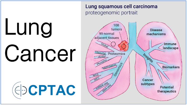 Image of Lung Cancer map developed by CPTAC. On right side contains illustration of lung entitled "Lung squamous cell carcinoma proteogenomic portrait". The illustration has a red tumor added to the primal bronchii with the text above it stating 108 tumors. Text next to the tumor states "99 normal adjacent tumors". Each bronchii branch includes an keyword from the research study: global, proteomics, ubiquityl, acetyl, phospho, genomics, methylation, WGS, WES, mRNA-seq, RNA-seq
