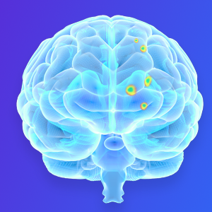 Image of a stylized brain scan, areas lit up in yellow, on a blue background 
