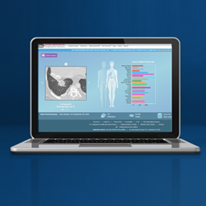 Homepage of the NCI Imaging Data Commons (IDC). On the left is a black and white image of Computed Tomography. In the middle are silhouttes of male and female bodies, highlighting main organs. On the right shows a colorful chart that outlines the number of cases by body site that are available for viewing in the NCI IDC.