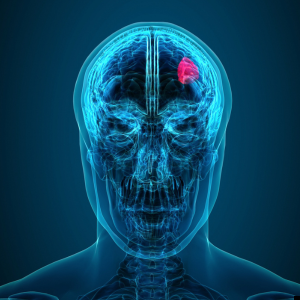 X-Ray scan of a human displaying a tumor in the brain