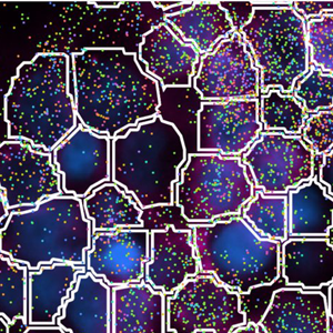 Tissue biopsy segmentation of a human lung. Blue and green shading shows different cell types and structures. Cell boundaries are outlined in white. 